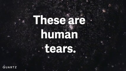 Micrograph photos reveal the unique beauty of tears