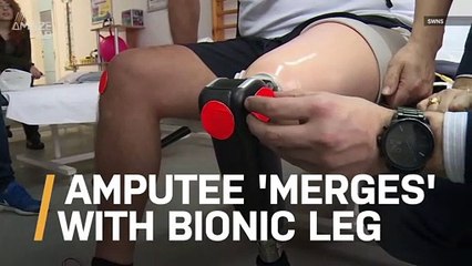 Amputee Can Feel Bionic Leg After ‘Merging’ With It