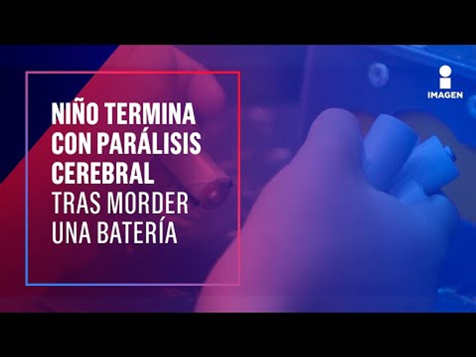 Niño muerde una pila y termina con parálisis cerebral | Noticias con Yuriria Sierra