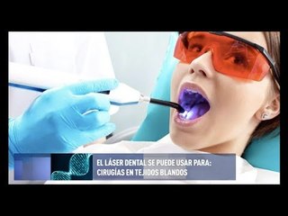 Beneficios de la odontología láser