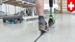 New bionic prosthetic allows amputees to feel their leg