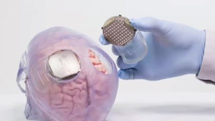 Diseñan un exoesqueleto para tetrapléjicos que permite el movimiento de brazos y piernas