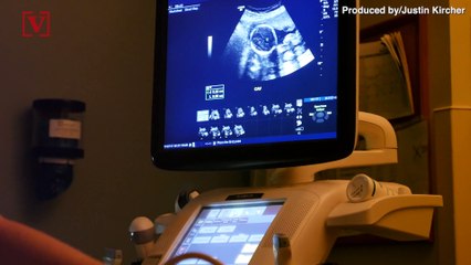 Louisiana Abortion Law to be Heard by U.S. Supreme Court