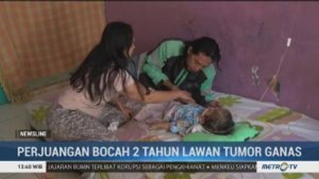 Bocah 2 Tahun Berjuang Lawan Tumor Ganas
