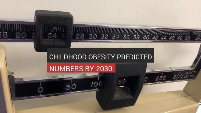 Childhood Obesity Alarming Rates by 2030