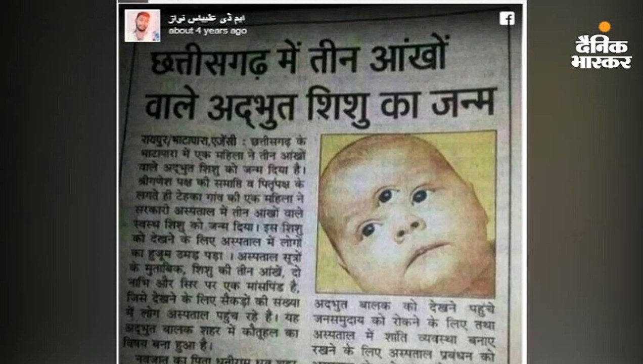 सच में पैदा हुआ था तीन आंखों वाला बच्चा लेकिन य...