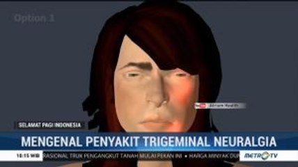 Kenali Gejala Nyeri Trigeminal Neuralgia