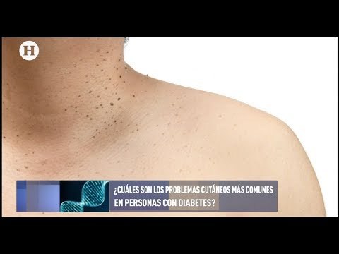‍Tratamientos y cuidados de la piel en pacientes diabéticos