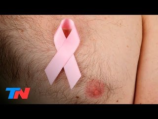 Cáncer de mama en hombres: todo lo que hay que saber y cómo cuidarse