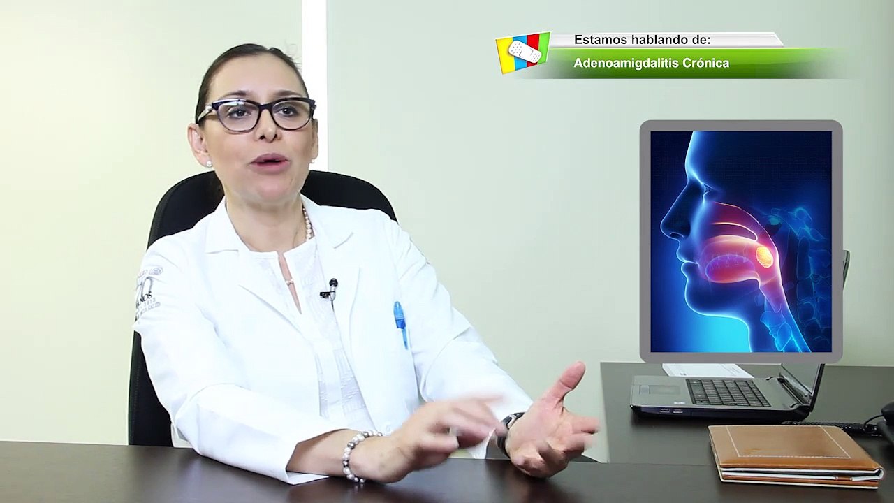 002 DRA CORTES_ADENOAMIGDALITIS CRONICA