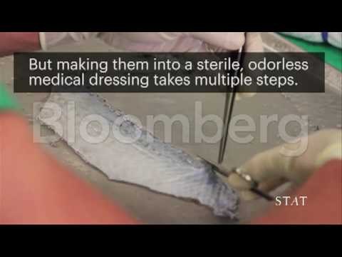 Tilapia Fish Skin Used to Heal Burnt Skin