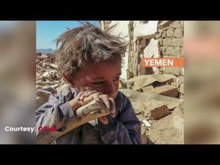 Clashes in Yemen Kill 40 People
