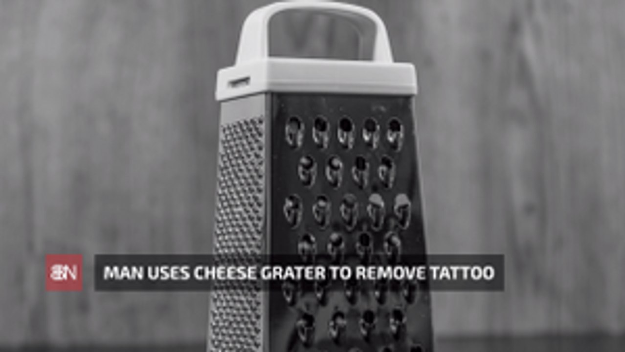 This Is Not How You Remove A Tattoo