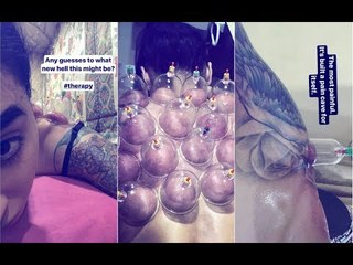 Bigg Boss 10’s Bani J Is Going Through Hell And Covered In Marks | TV | SpotboyE