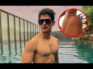 OMG! Priyank Sharma Detected With Extra Bone In Thigh, Heads For An Immediate Surgery