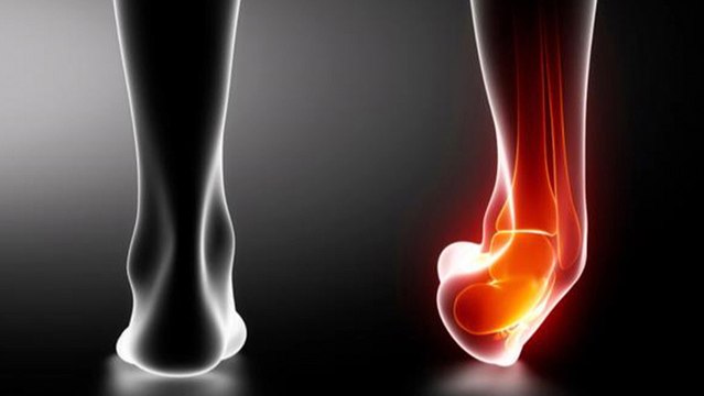 bd-formas-tratar-esguinces-091019