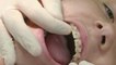 Santé - Trottinettes : attention les dents !