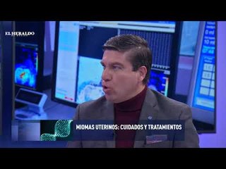 Embolización, un nuevo método para combatir los miomas uterinos