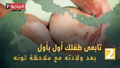 فيديو معلوماتى.. طفلك عنده الصفراء؟.. 5 نصائح لحمايته منها