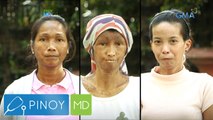 Pinoy MD: Tatlong babae, pinahihirapan ng sakit na Scleroderma