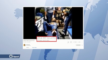 كما سرقت الأرض..ميليشيا قسد تسرق صور ضحايا القصف بحلب وإدلب والغوطة وتتخذ المدنيين دروعا بشرية