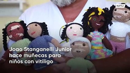 Abuelo tejedor crea muñecas con vitiligo para enseñar a los niños positividad corporal