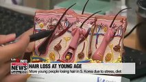 More young people losing hair in S. Korea due to stress, diet