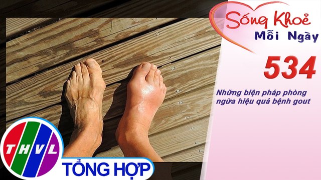 THVL | Những biện pháp phòng ngừa hiệu quả bệnh gout | Sống khỏe mỗi ngày - Kỳ 534