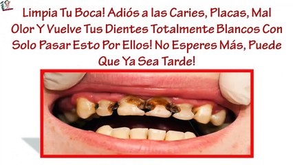 ¡Inventan en España un método para decirle adiós a las caries para siempre!