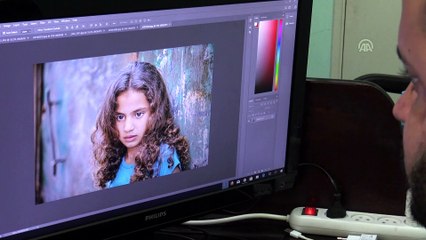 İsrail askerlerinin yaraladığı Filistinli: 'Yaşadıklarım, hayatımı altüst etti' - GAZZE