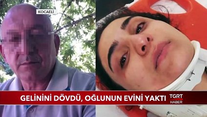 Gelinini Dövdü, Oğlunun Evini Yaktı