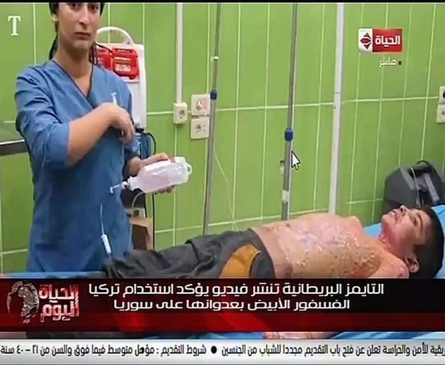 تقرير لـ" الحياة اليوم" يكشف جرائم أردوغان فى سوريا