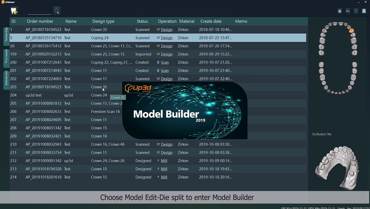 UP3D dental model builder software