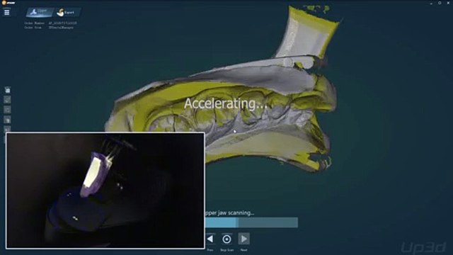 Triple tray dental impression scanning