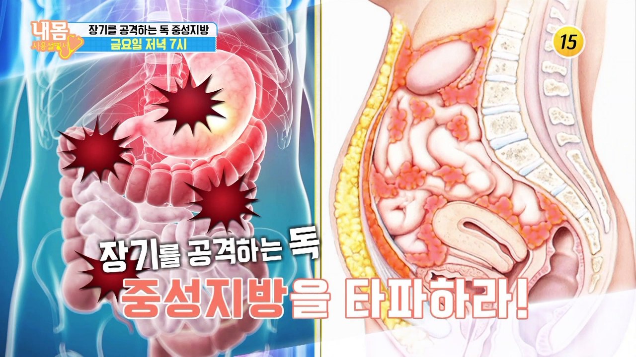 장기를 공격하는 독 중성지방_내 몸 사용설명서 273회 예고