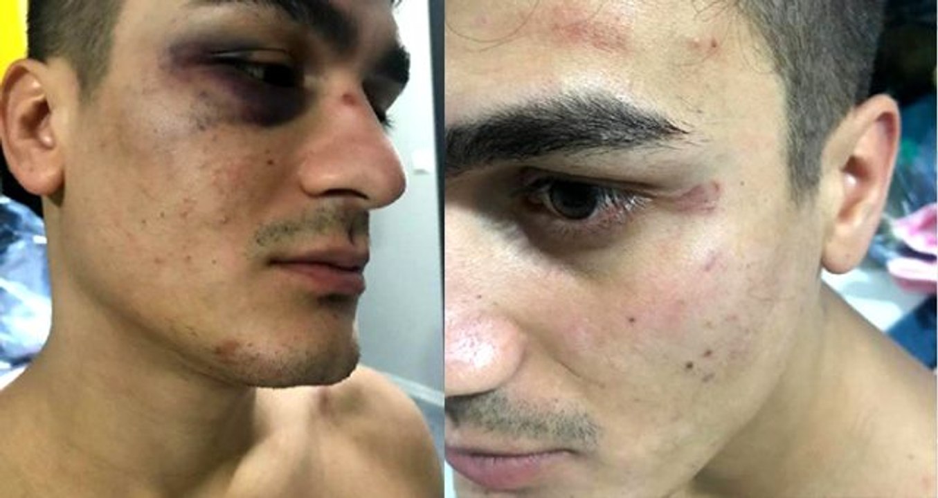 Evde yüksek sesle müzik dinleyen öğrencilere, darp ve biber gazlı müdahale