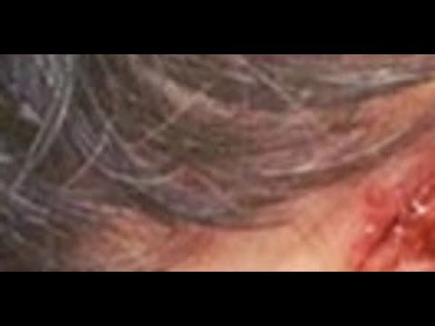 Stéphane Plaza, visage en sang, terrifiante blessure, photo choc