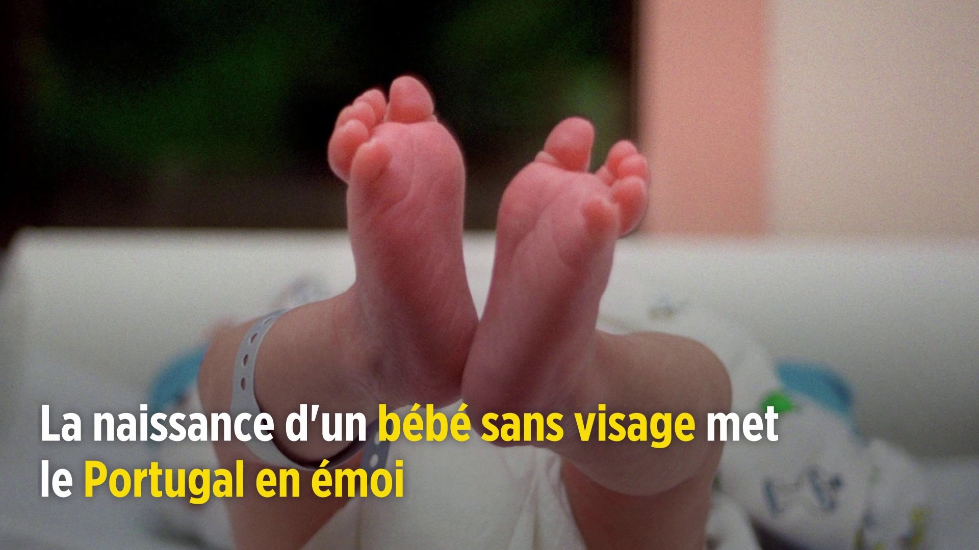 Portugal La Naissance D Un Bebe Sans Visage Met Le Pays En Emoi Video Dailymotion