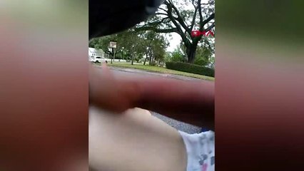 Abd polisi, nefes borusuna kraker kaçan bebeği böyle kurtardı