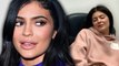 Kylie Jenner Surgery Explained In New Video