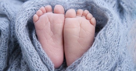 La naissance d'un bébé sans visage bouleverse le Portugal