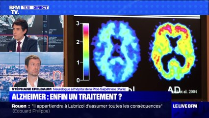 Alzheimer: enfin un traitement ? (2) - 25/10