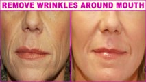 Top 5 Natural Home Remedies For Wrinkles Around Mouth