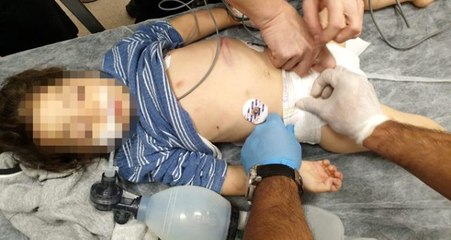"Üzerine motosiklet düştü" denmişti! Komaya giren çocuğu üvey annesinin dövdüğü ortaya çıktı