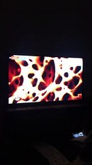 Sickle cell anaemia may just get a solution