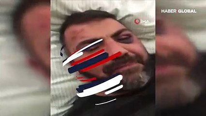 Almanya'da skandal Türk vatandaşını darp edip sokağa attılar