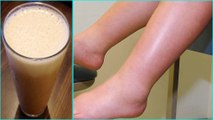 The Natural Home Remedies To Get Rid Of Swollen Legs