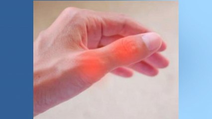 bd-rizartrosis-causas-tratamientos-281019