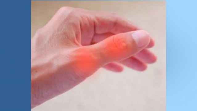 bd-rizartrosis-causas-tratamientos-281019