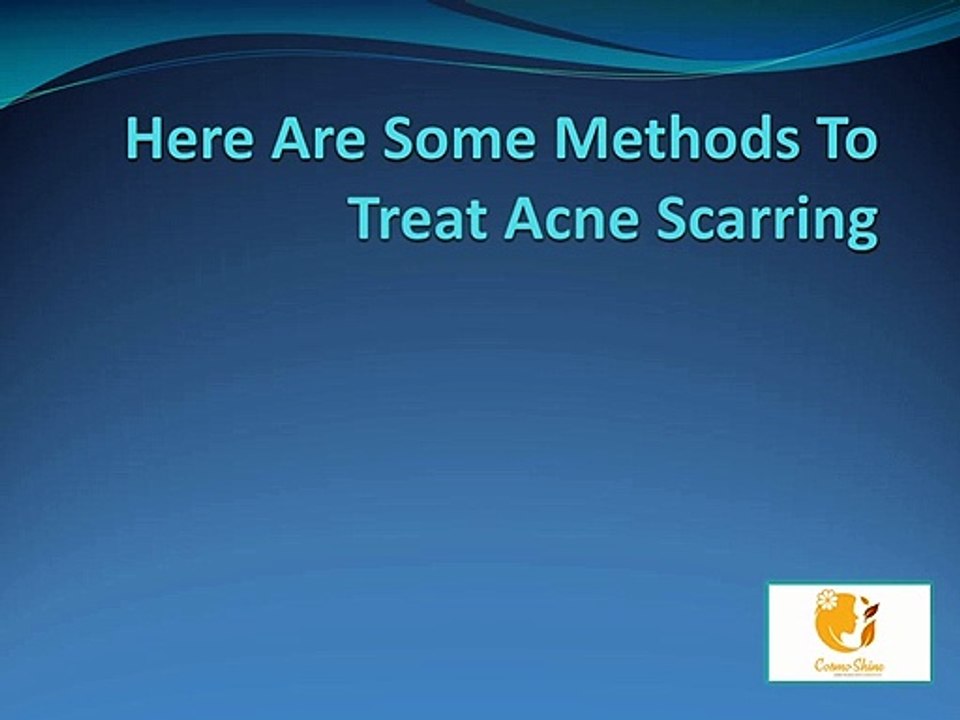 Here Are Some Methods To Treat Acne Scarring